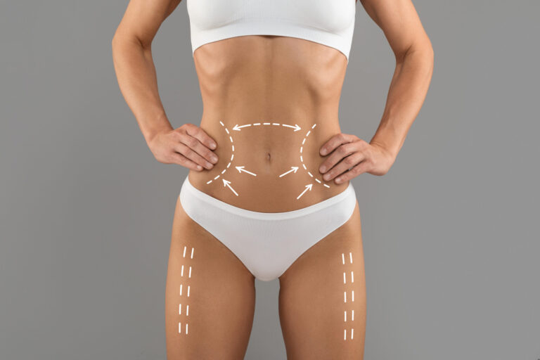 Body Contouring Concept. Slim Female Body With Drawing Fit Lines And Arrows On It, Unrecognizable Young Woman With Sporty Figure In White Underwear Standing Over Grey Background, Collage SSUCv3H4sIAAAAAAAACnRSy26DMBC8V+o/IJ+DCiFAyLGH3ir11kPUw2I2YMXYkR+poij/Xj9Ca1XtjZ3ZnZ3xcn18yDLSg2aU7LKrr1zNOLfaKDBMCgcXqzuuUAyoUuSsqqZIARyYkYoBT8EeDJ0EzOhAYTn38C2QRBswVqP22+8QBYOj04jgt0S0uI91thCBdBOOIs8I1lyeXkBP3vgq6dC29x2vTFPkHARKq8nCx73/iL6hPHH8S+xdzih+ROLHx5IZRhT0EmIlcRVyhBh3H1vJ8dOgmtMHADswmWQ/SwrcN1SJ0kkxysSYjEkzheMsY1zKE/TO+y47uHlcnE2gtbRi+I1TBxrlLZN12YVgy0Xc3yDnZJWQJmQg8V3I4E7my7KqiqarN0277dq269ry3hDPPDGnEzYsQq6mRzak6Zk3Rhp6aOqm3uS0b+p8Q6sqh4J2eQltu4W1owpv8fYFAAD//wMA2OQhaMECAAA=